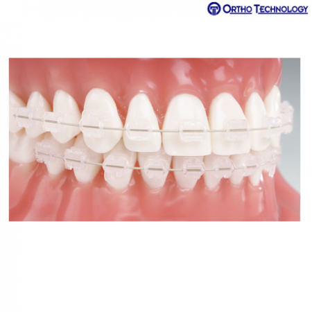 Ortho Technology Reflections Roth RX V-Slot 5x5 Single Patient Kits