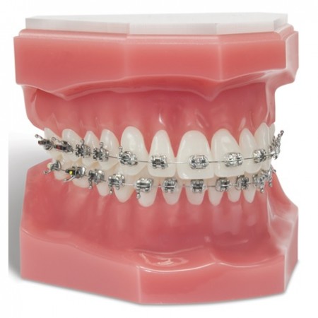Ortho Technology OrthoFlex Typodonts