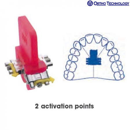 Ortho Technology 3-Directional Expansor 16mm #A0931-16