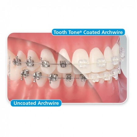 Ortho Technology Tooth Tone Coated Stainless Steel Full Form Archwire Rectangle, 10 archwires/pack