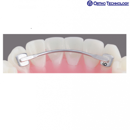 Ortho Technology Bondable Lingual Retainers