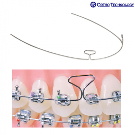 Ortho Technology TruForce Stainless Steel Retraction Archwires-4 Key hole