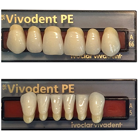 Ivoclar SR Vivodent PE Shade 110/01 For Anterior teeth  (set of 6)