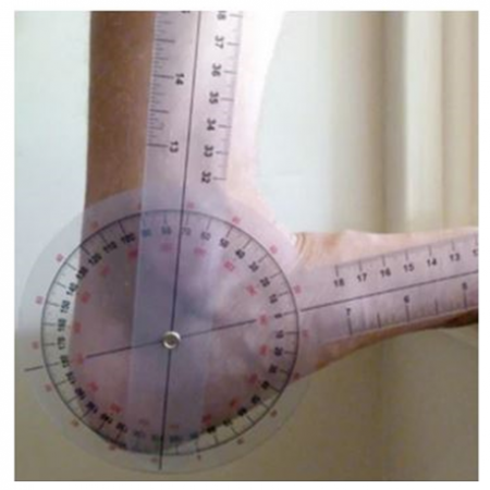 Medpro Protractor Goniometer, Medical Ruler, 6