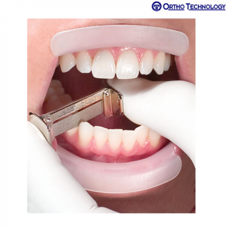 Ortho Technology Mini Stripper Double-Sided Stainless Steel Strips