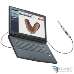 Condor Intra-Oral Scanner