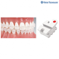 Ortho Technology Reflections Roth RX V-Slot (10 Brackets/Pack)