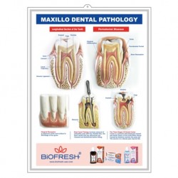 Medical Chart Design, Teeth Poster (50x70cm) Laminated