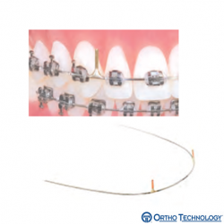 Ortho Technology TruForce Stainless Retraction Brass Post Archwire