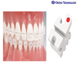 Ortho Technology Reflections Standard Edgewise RX 10 Packs