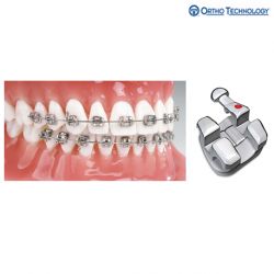 Ortho Technology Marquis Brackets 10 Pack MBT