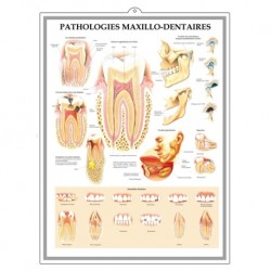 Medical Chart Design, Teeth Poster (50x70cm) Laminated