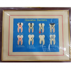 Endodontic Educational Chart Frame