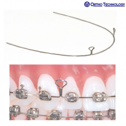 Ortho Technology TruForce Stainless Steel Retraction Archwires-2 Key hole
