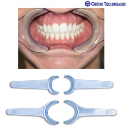 Ortho Technology Photo Cheek Retractor