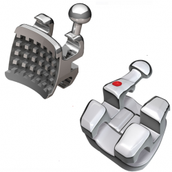 Marquis Standard Edgewise Bracket system