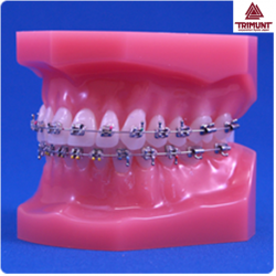Patient Education Anatomical Teeth Model