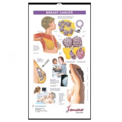 Medical Chart Design, Breast Cancer (42.6x78cm) Laminated