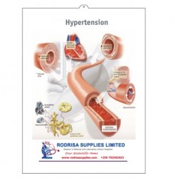 Medical Chart Design, Hypertension (50x70cm) Laminated